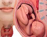 کم کاری تیروئید و بارداری کم کاری تیروئید و بارداری