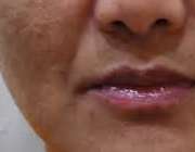 لک صورت