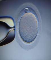 باروری به روش ivf