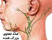 غدد لنفاوی