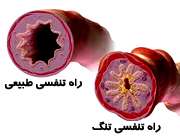 با صدا نفس کشیدن
