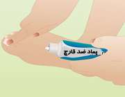 قارچ انگشتان پا
