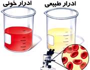 ادرار خونی