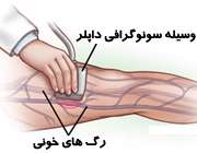 سونوگرافی داپلر