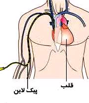 پیک لاین