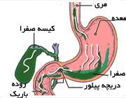 ریفلاکس صفرا