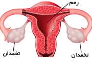 رحم و تخمدان زنان
