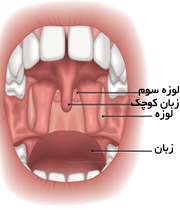 لوزه