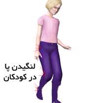 لنگیدن پاها در بچه ها