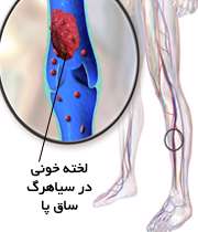 لخته شدن خون