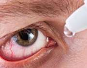 چشم قرمز