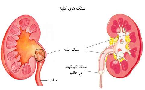 تولید بیوگاز با پسماند سیب
