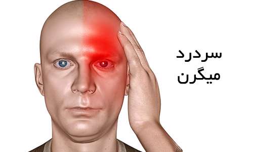 سردرد میگرن
