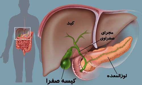 کیسه صفرا