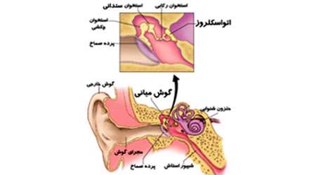 اندام های حسی