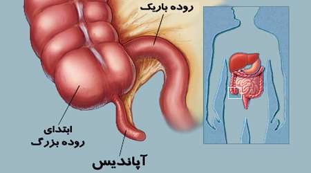 آپاندیس
