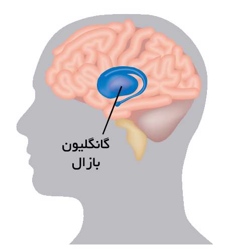 بیماری هانتینگتون