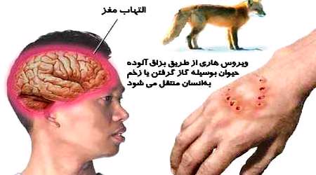 بیماری هاری
