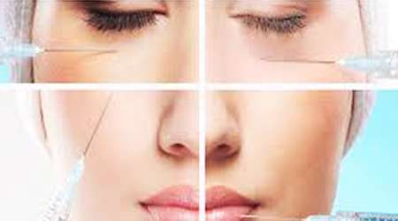 تزریق ژل و فیلر در صورت