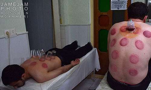 هشدار درباره حجامتهای زیرزمینی هشدار درباره حجامتهای زیرزمینی
