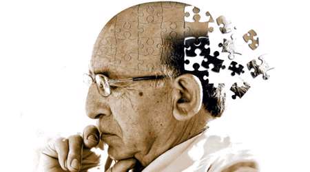 زوال عقل