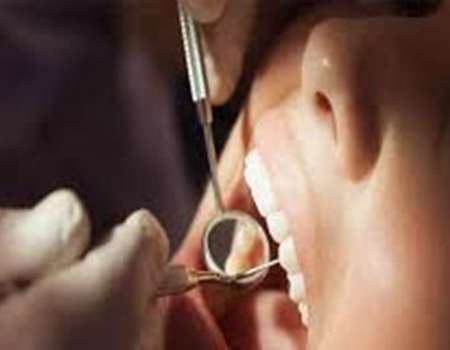 طبيب اسنان ايراني يتحدث عن اسباب تسوس الاسنان 