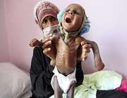 یمنی بچے مدد کے منتظر ہی