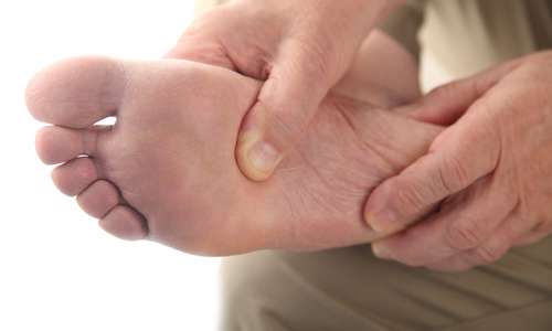 5 مشکل شایع در پاها 5 مشکل شایع در پاها