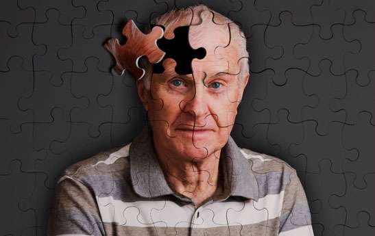 آلزایمر: تعریف، علل و تغذیه درمانی آلزایمر: تعریف، علل و تغذیه درمانی
