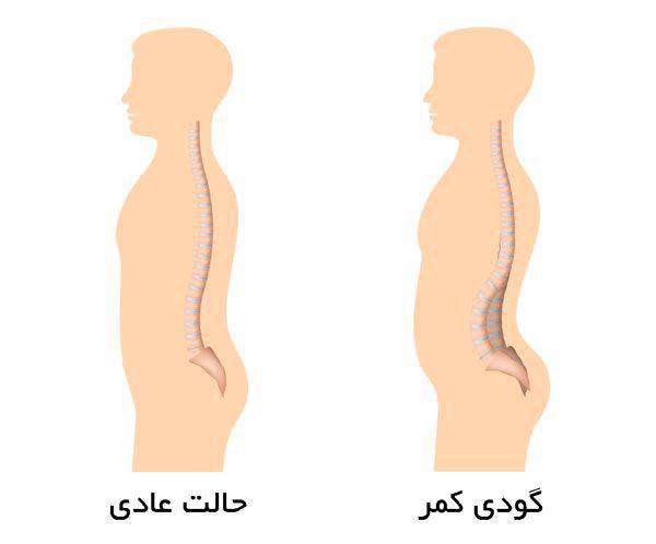 گودی کمر