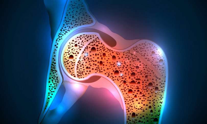 داروهای ضد افسردگی عامل بروز پوکی استخوان