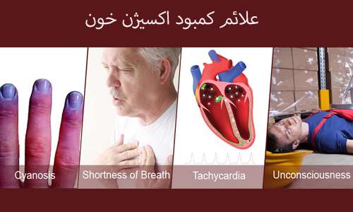 علائم هشداردهنده کاهش اکسیژن خون علائم هشداردهنده کاهش اکسیژن خون