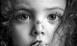 عکسهایی از زیبایی رو به زوال کودکان پروانهای در «به نام پروانه» عکسهایی از زیبایی رو به زوال کودکان پروانهای در «به نام پروانه»