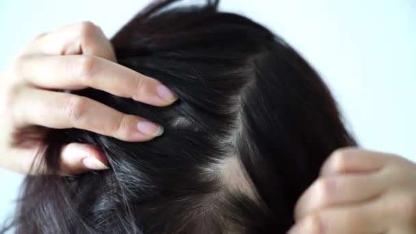7 حقیقت درباره الگوی طاسی در زنان 7 حقیقت درباره الگوی طاسی در زنان