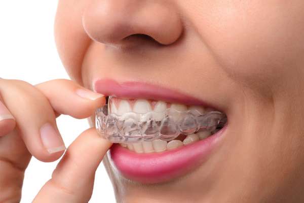 نایت گارد