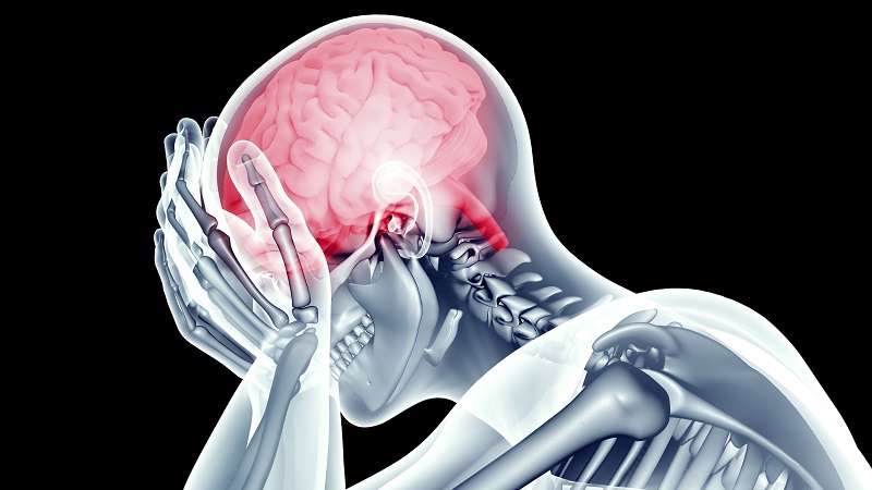 سکته مغزی از علائم تا توصیههای پیشگیرانه سکته مغزی از علائم تا توصیههای پیشگیرانه
