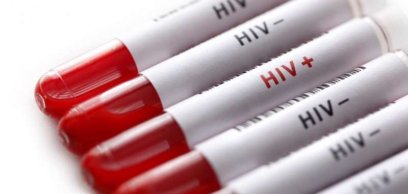 وجود ۶۰ هزار بیمار HIV در ایران وجود ۶۰ هزار بیمار HIV در ایران