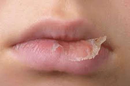 پوشش دهنده لب ویتامینه خوراکی پوشش دهنده لب ویتامینه خوراکی