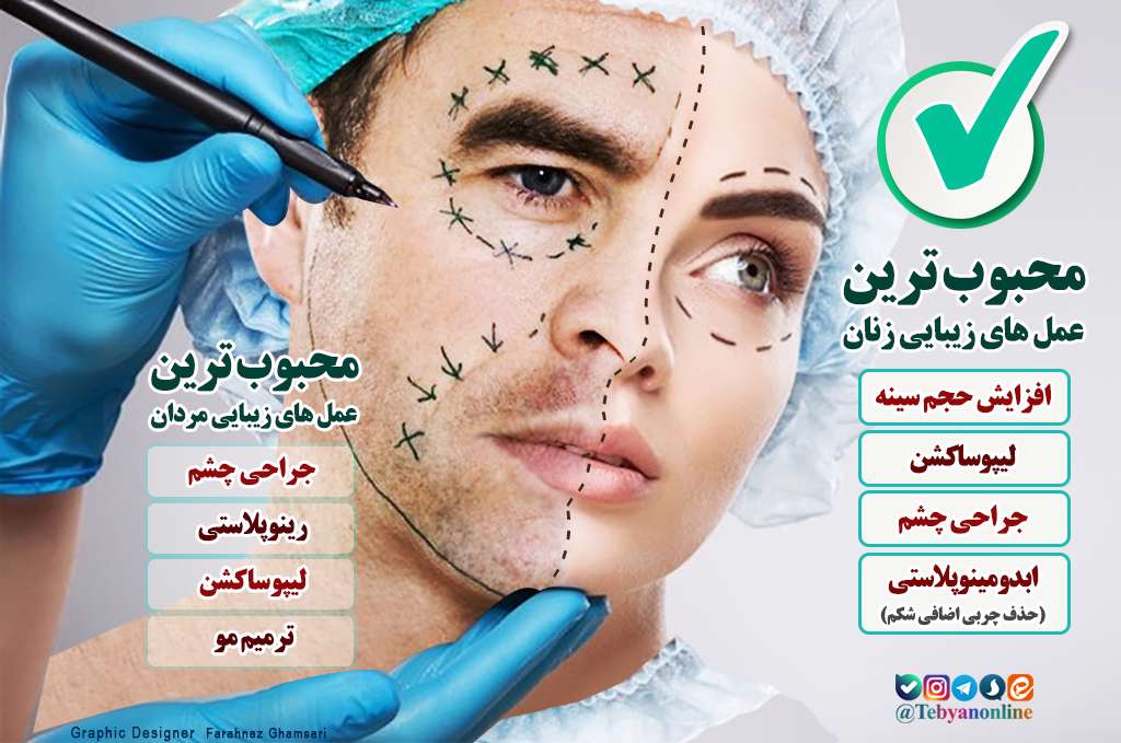 "تبیان" جراحی زیبایی در کشورهای مختلف را بررسی می کند "تبیان" جراحی زیبایی در کشورهای مختلف را بررسی می کند