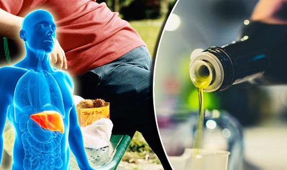 غذاهای مضر برای کبد چرب را بشناسید غذاهای مضر برای کبد چرب را بشناسید