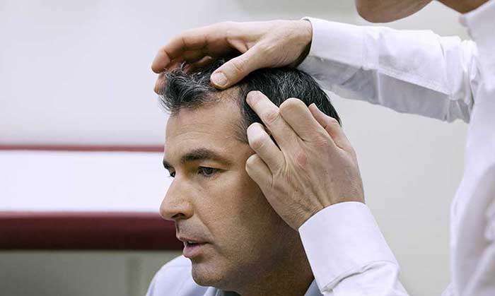 الگوی طاسی مردانه و درمان با دارو، تزریق prp و کاشت موی طبیعی