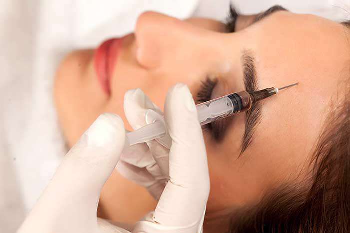 تزریق بوتاکس صورت برای رفع چروک دور لب، چشم و پیشانی