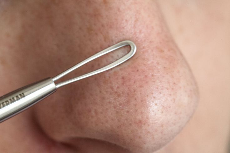 6 نکته برای پاکسازی منافذ پوست بینی 6 نکته برای پاکسازی منافذ پوست بینی
