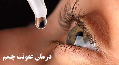عفونت چشم چیست و چگونه درمان می شود؟ عفونت چشم چیست و چگونه درمان می شود؟