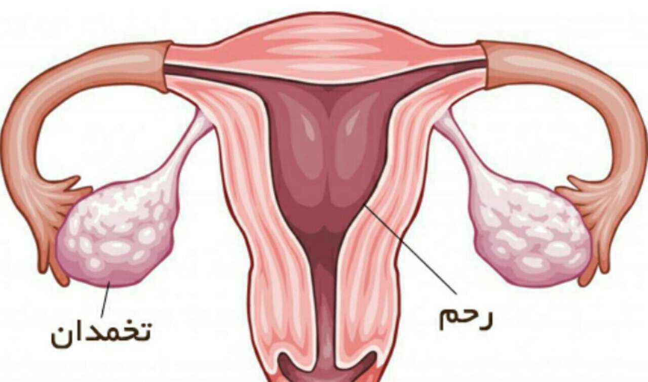 رحم و تخمدان