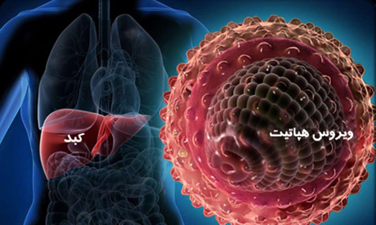 بیماری کبد، کبد ملتهب، هپاتیت، هپاتیت c ، ویروس هپاتیت، التهاب کبد،