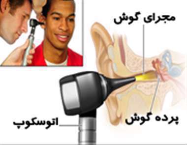 گوش، مجرای گوش، پرده گوش، گوش شناگر، عفونت گوش،