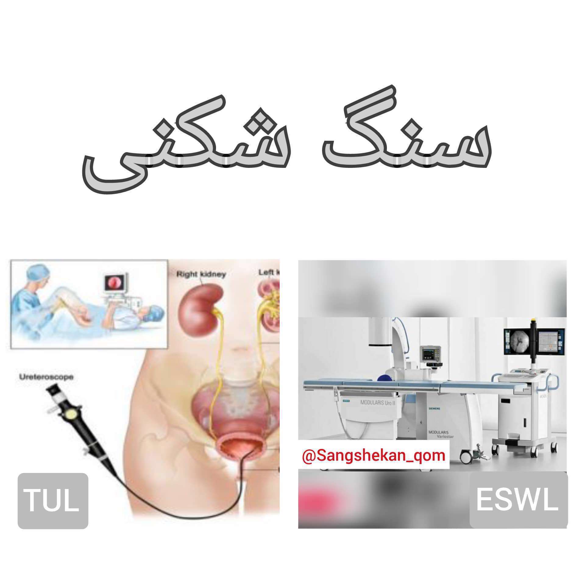 سنگ شکنی