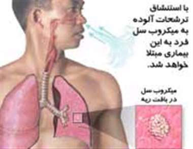 سل ریوی، میکروب سل،