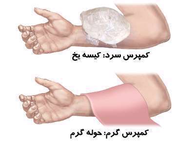 درمان کبودی در خانه